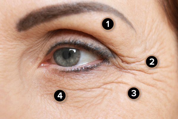 Dermal FIllers - Eye treatments